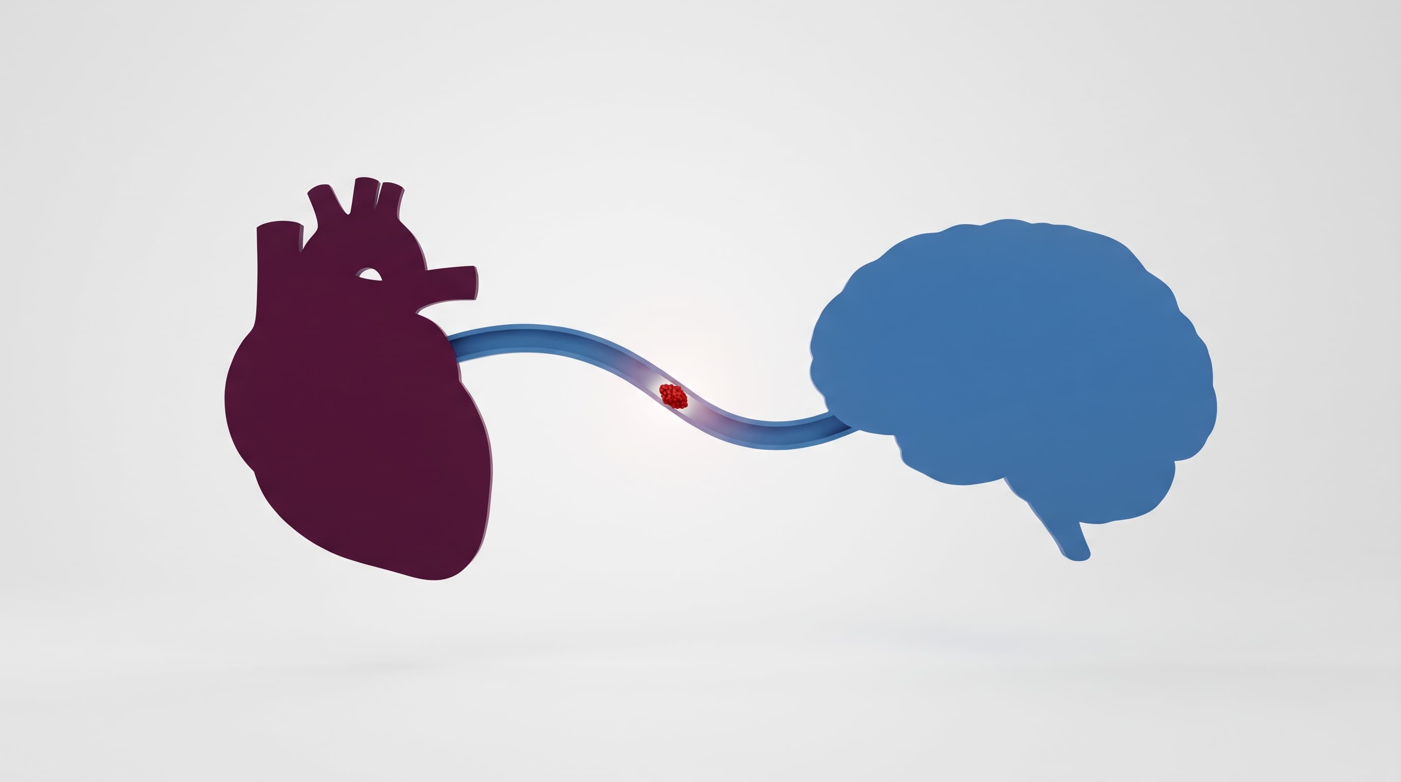Accidente cerebrovascular cardioembólico