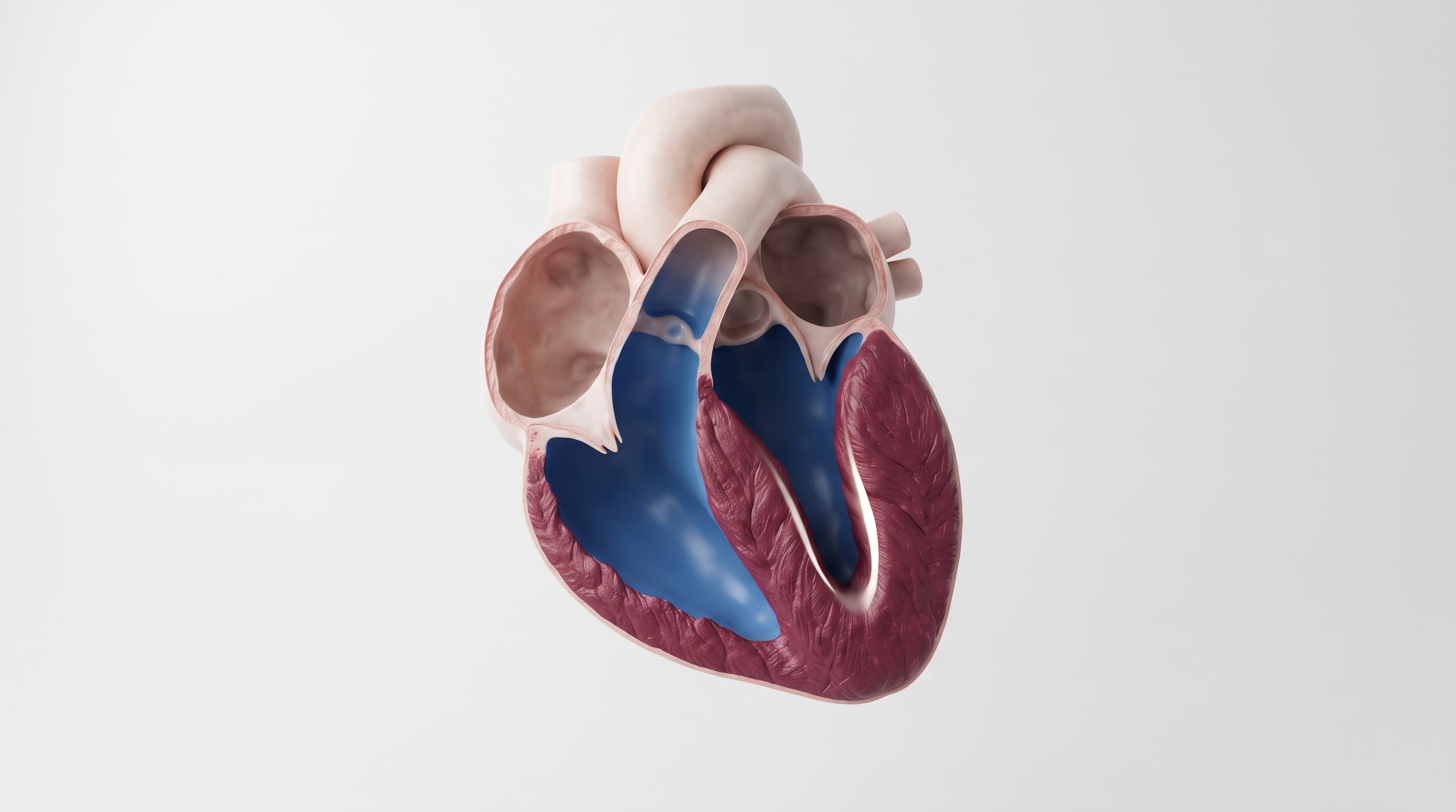 Cardiopatía hipertensiva